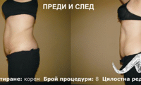 Биволъ