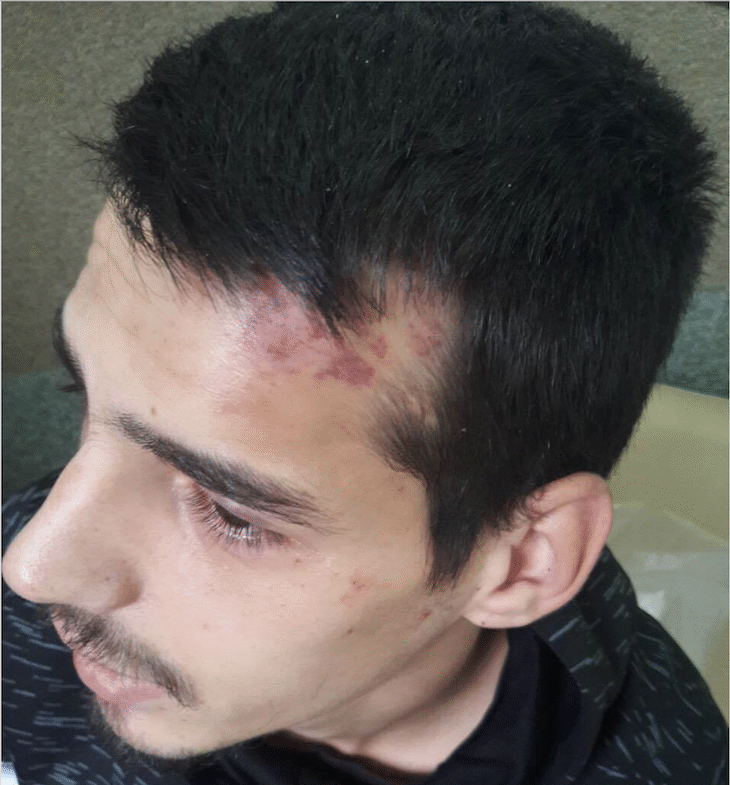 Пребиха зверски младеж във Враца заради разкрития по нарко-канал